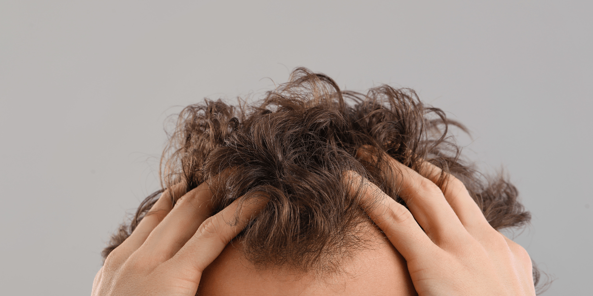 Cómo el Estrés Afecta la Caída del Cabello y Qué Puedes Hacer al Respecto - Süpp